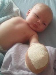 Baby with hand bandaged