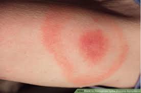 lyme disease tick rabies vaccinate dogs wise prevent traveling countries should dog if other